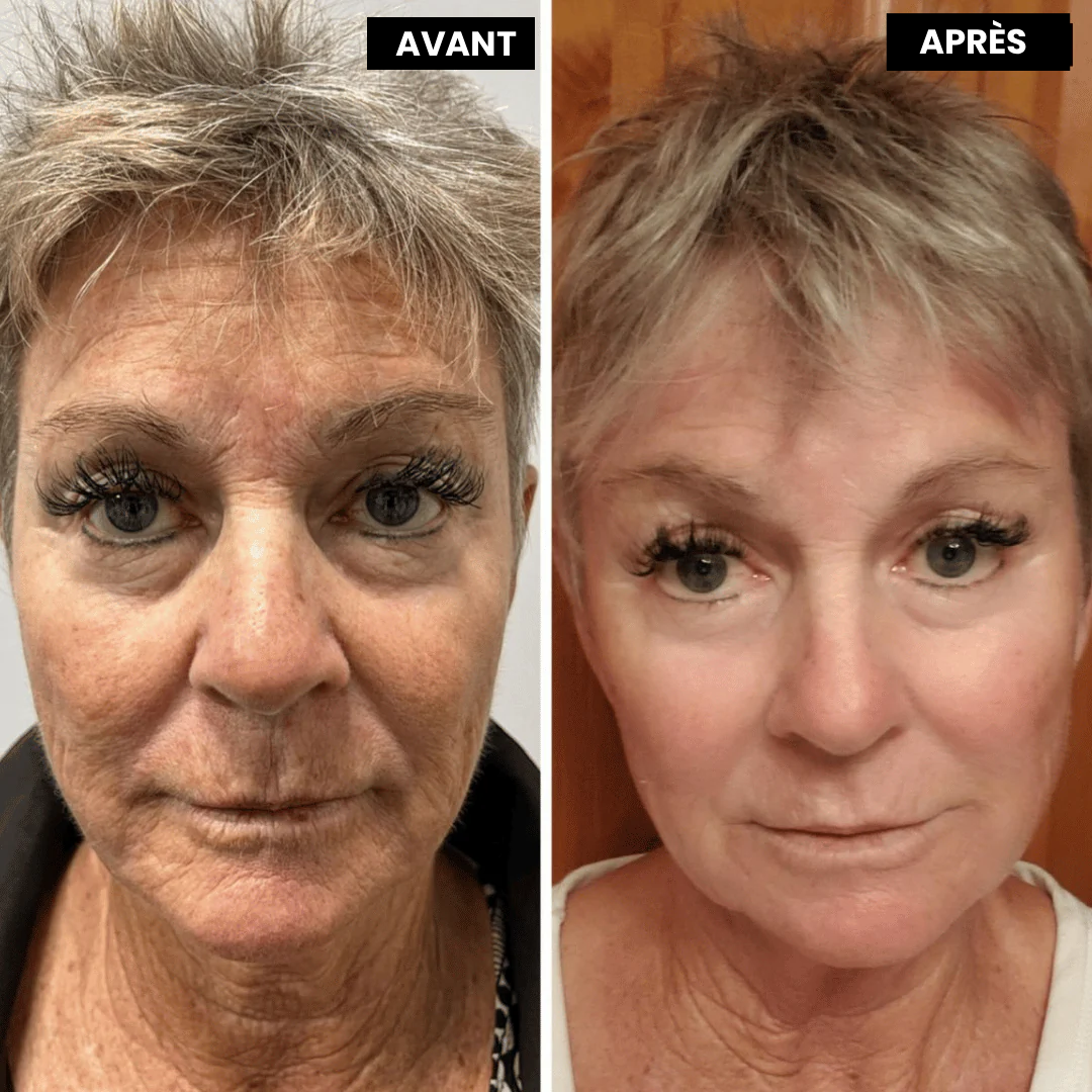 Retivelle™ L’alternative nouvelle génération au rétinol