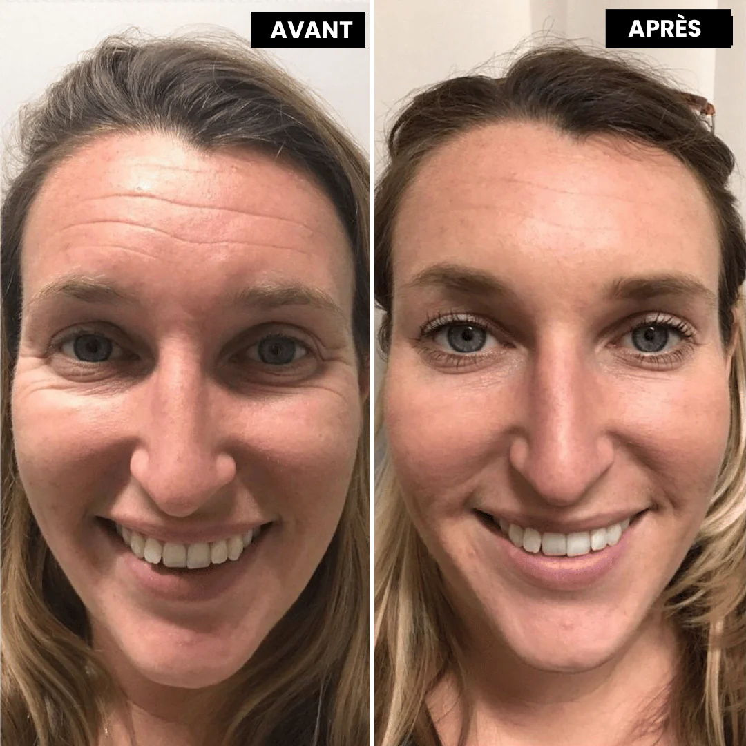 Retivelle™ L’alternative nouvelle génération au rétinol